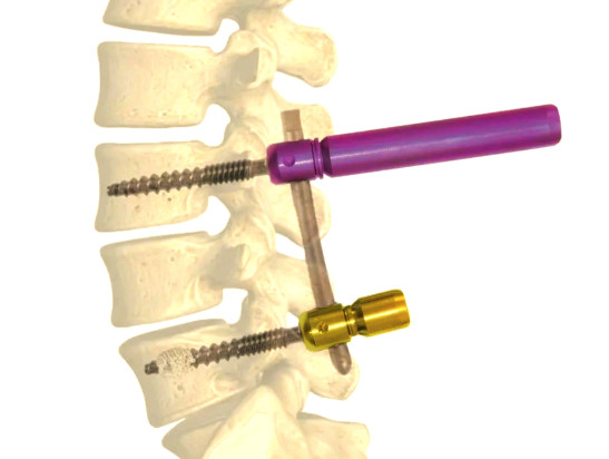 Bone Screws: Types, Specifications and Applications 01:42 3
